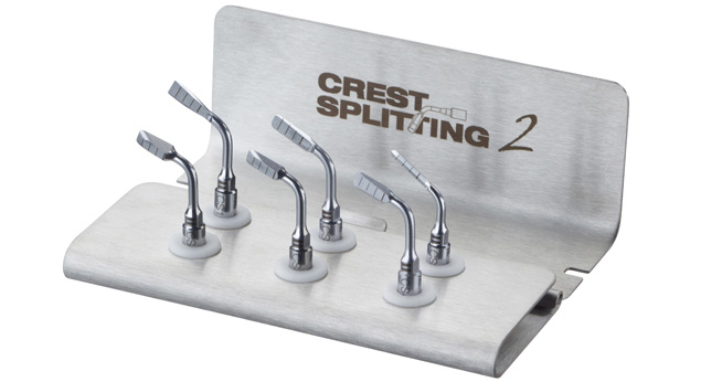 Crest Splitting Kit