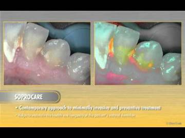 Pedagogic video for the SOPROCARE advantages and functionnalities !