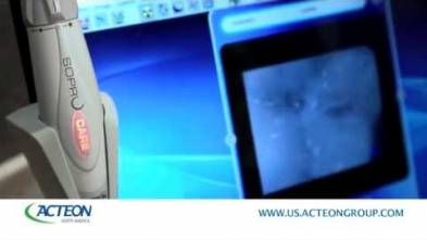 Use of Soprocare camera by Acteon US