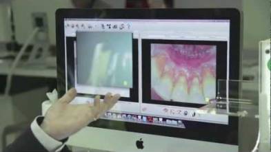 SOPROCARE demonstration at IDS 2013