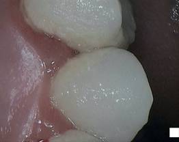 SOPROCARE - Clinical case 3