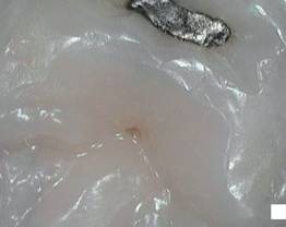 SOPROCARE - Clinical case 7