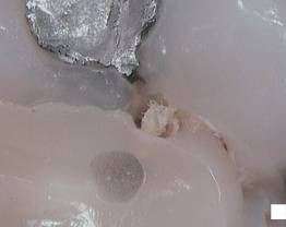 SOPROCARE - Clinical case 9