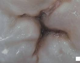 SOPROCARE - Clinical case 10