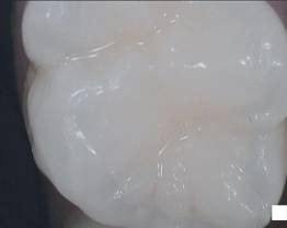 SOPROCARE - Clinical case 11