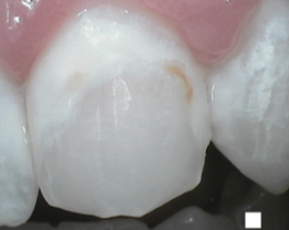 SOPROCARE - Orthodontics n°1