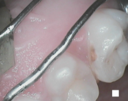 SOPROCARE - Orthodontics n°3