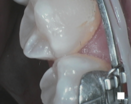 SOPROCARE - Orthodontics n°5