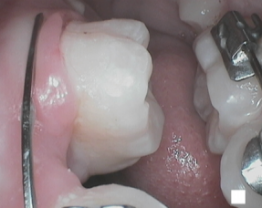 SOPROCARE - Orthodontics n°6