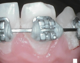 SOPROCARE - Orthodontics n°7