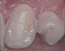 SOPROCARE  - clinical case 6