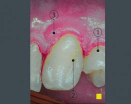 SOPROCARE - cas clinique 6 C vf