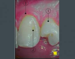 SOPROCARE - cas clinique 6 D vf