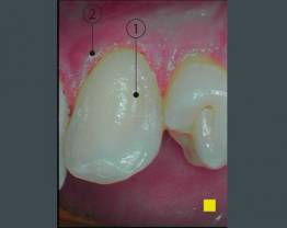 SOPROCARE - cas clinique 6 E vf