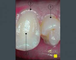 SOPROCARE - cas clinique 6 F vf