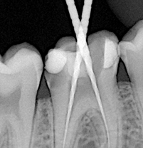 Sopix - clinical case 2-3