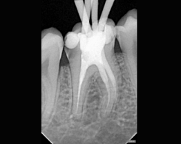 Sopix - clinical case 2-2