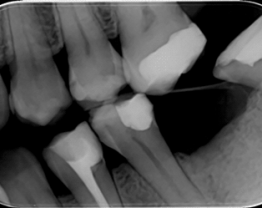 PSPIX Cas clinique 2