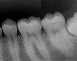 PSPIX Cas clinique 1-1