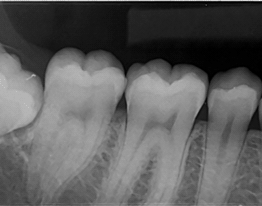 PSPIX Cas clinique 1-2