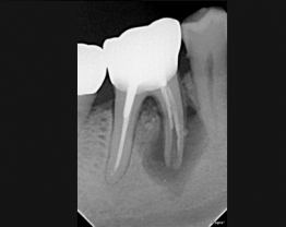 Sopix cas clinique 5