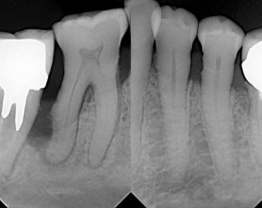 Sopix cas clinique 4-1