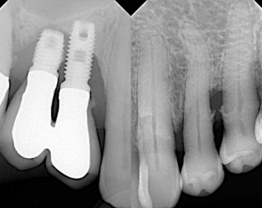 Sopix cas clinique 4-2
