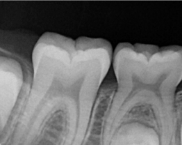 Sopix cas clinique 6-1