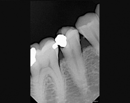 Sopix cas clinique 1