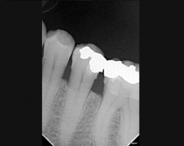 Sopix cas clinique 3-1