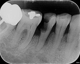 PSPIX Cas clinique 3-1