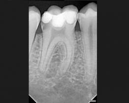 Sopix cas clinique 2-1