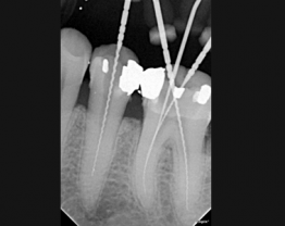 Sopix cas clinique 3-2