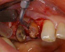 Dr Ouhayoun - clinical case 1