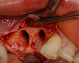 Dr Ouhayoun - clinical case 2