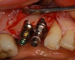 Dr Ouhayoun - clinical case 3