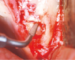 Dr Marin - clinical case 1