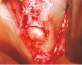 Dr Marin - clinical case 2