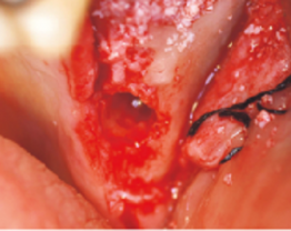 Dr Marin - clinical case 3