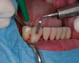 Dr Normand - clinical case 1