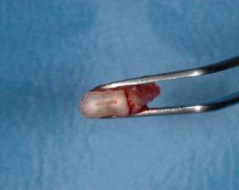 Dr Normand - clinical case 2