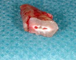 Dr Normand - clinical case 3