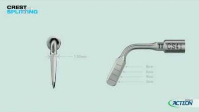 Crest Splitting 3D protocol
