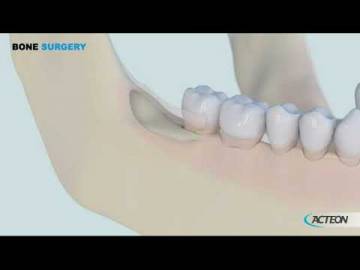 PIEZOTOME BS1S BS1L BS1RD