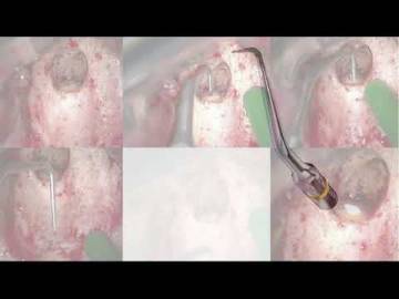 AS3D AS6D AS9D ASLD ASRD ENDODONTICS