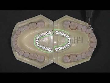 H4L H4R PERIODONTICS