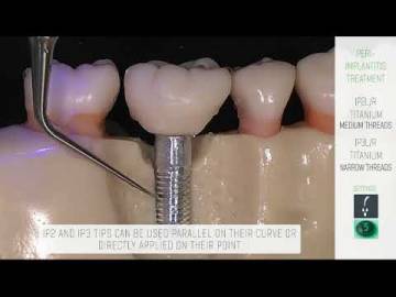 IP2L IP2R IP3L IP3R IMPLANT CARE