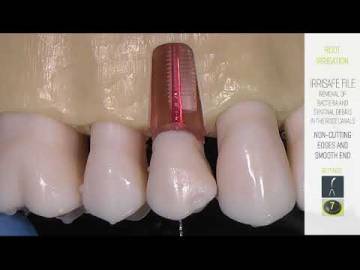 IRRISAFE ENDODONTICS