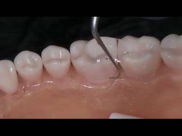 P2L P2R PERIODONTICS