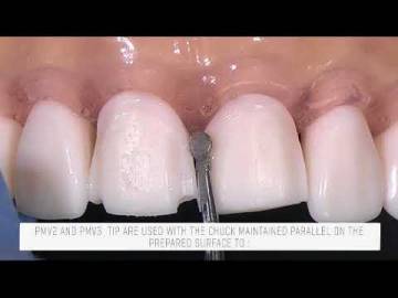 PMV2 PMV3 PROSTHESIS